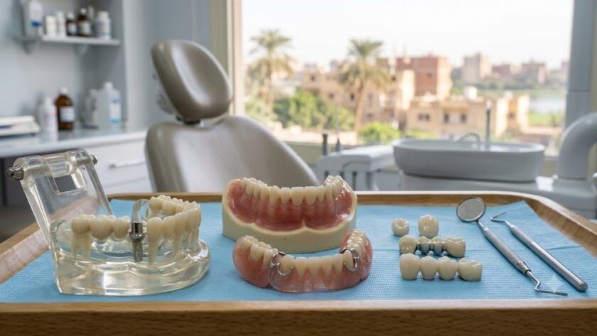 دليل تركيبات الأسنان